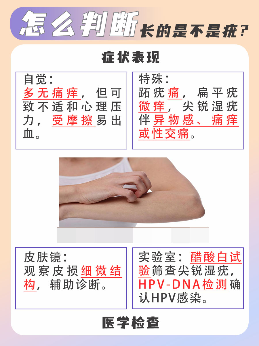 从形状到颜色，全面解析如何判断疣的真面目！