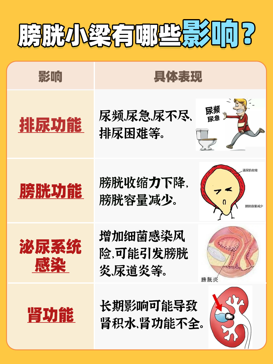 膀胱小梁形成：揭秘原因与应对策略