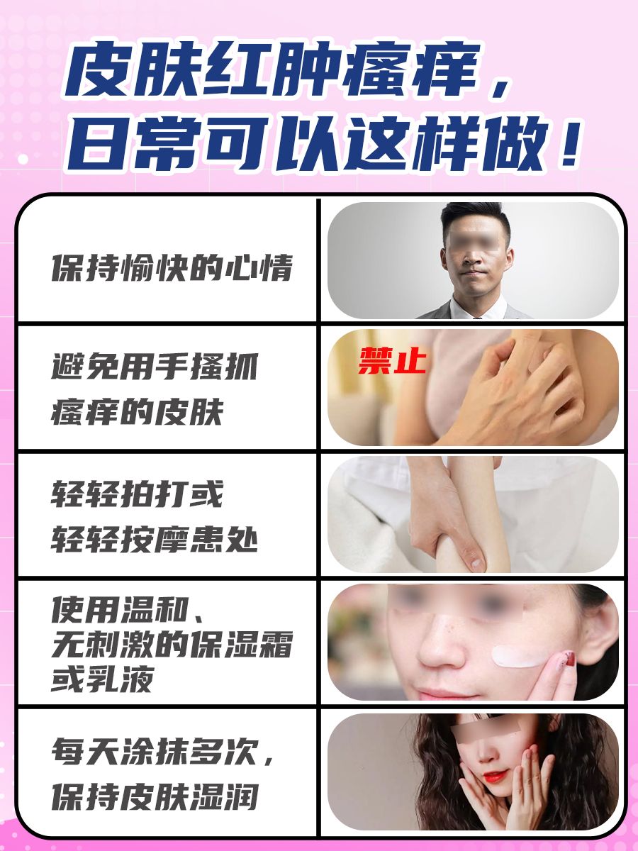 糠酸莫米松乳膏和醋酸地塞米松乳膏有啥区别?