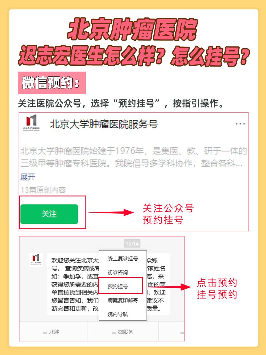北京肿瘤医院迟志宏医生怎么样？怎么挂号？