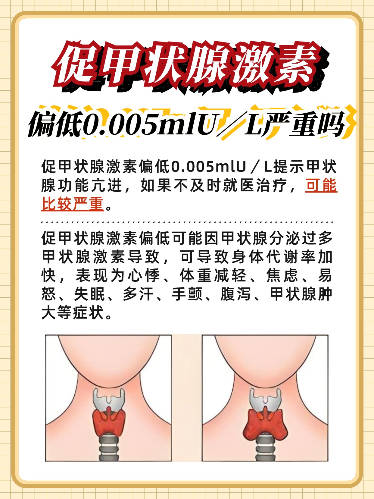 促甲状腺激素偏低0.005，严重吗？