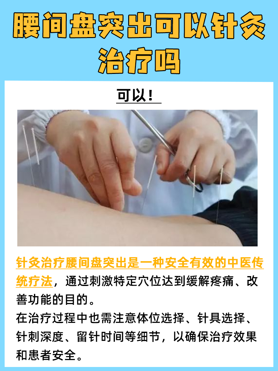 腰间盘突出可以针灸治疗吗?一文解析
