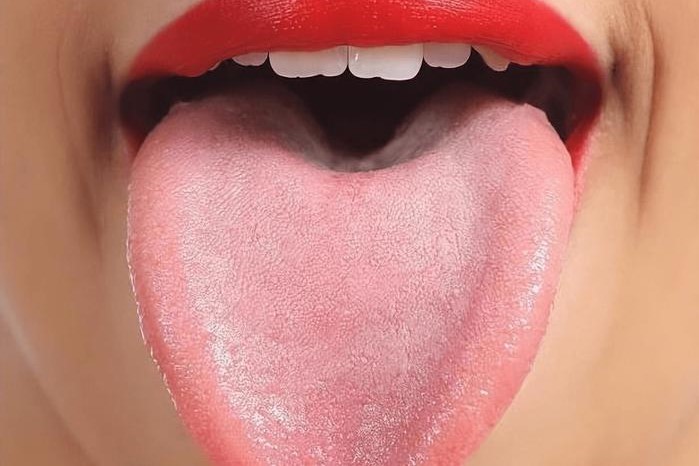 平和体质舌苔图