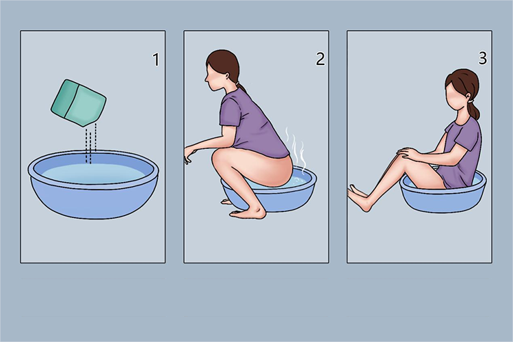 高锰酸钾坐浴图