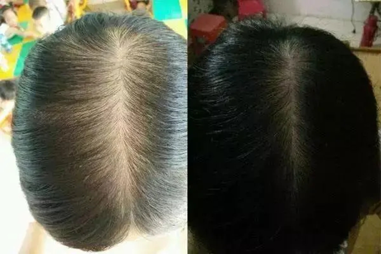 发缝宽窄程度对比图