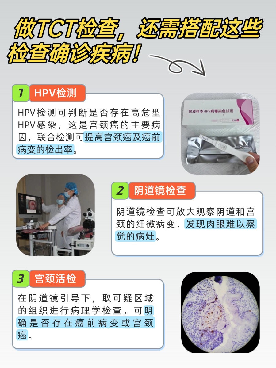 TCT 检查什么项目?妇科医生带你看懂