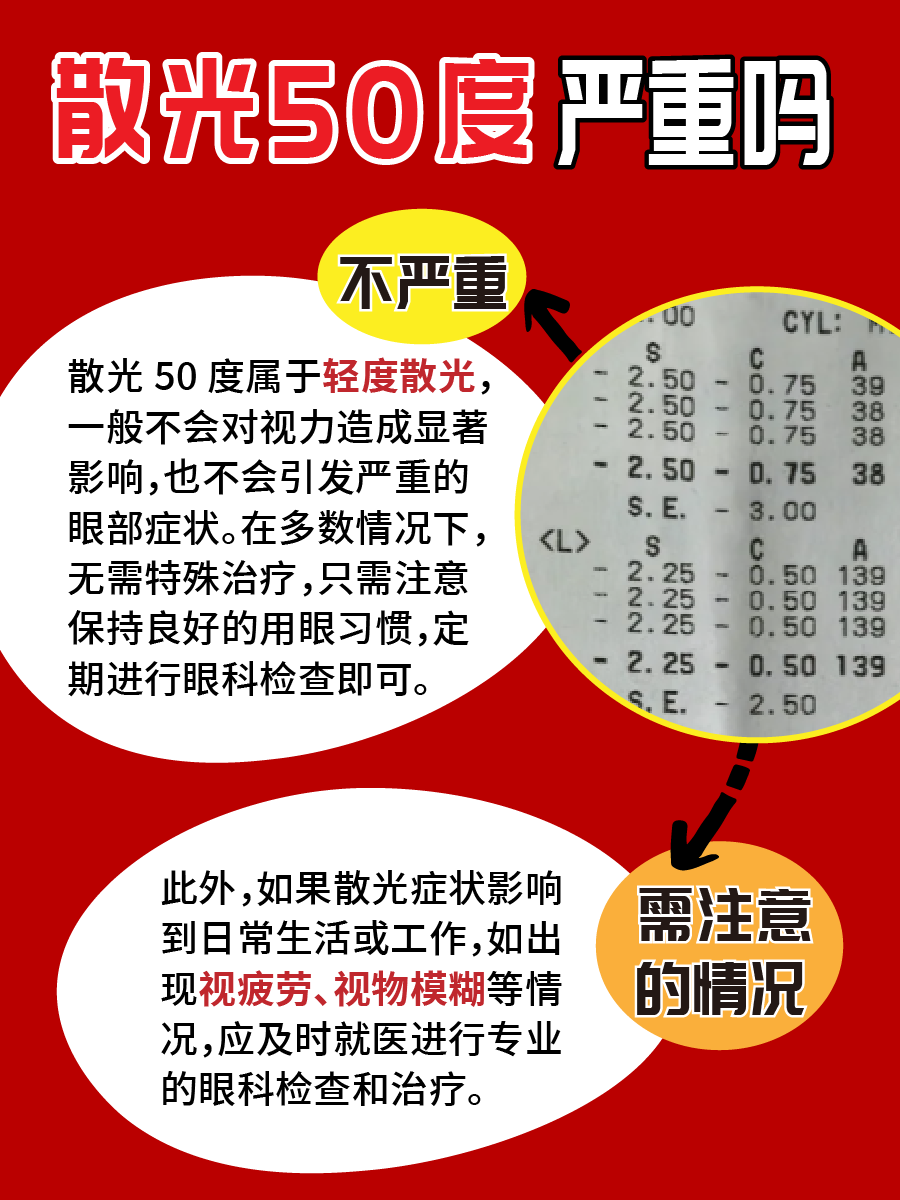 好奇50度散光对应多少近视？赶紧来一探究竟