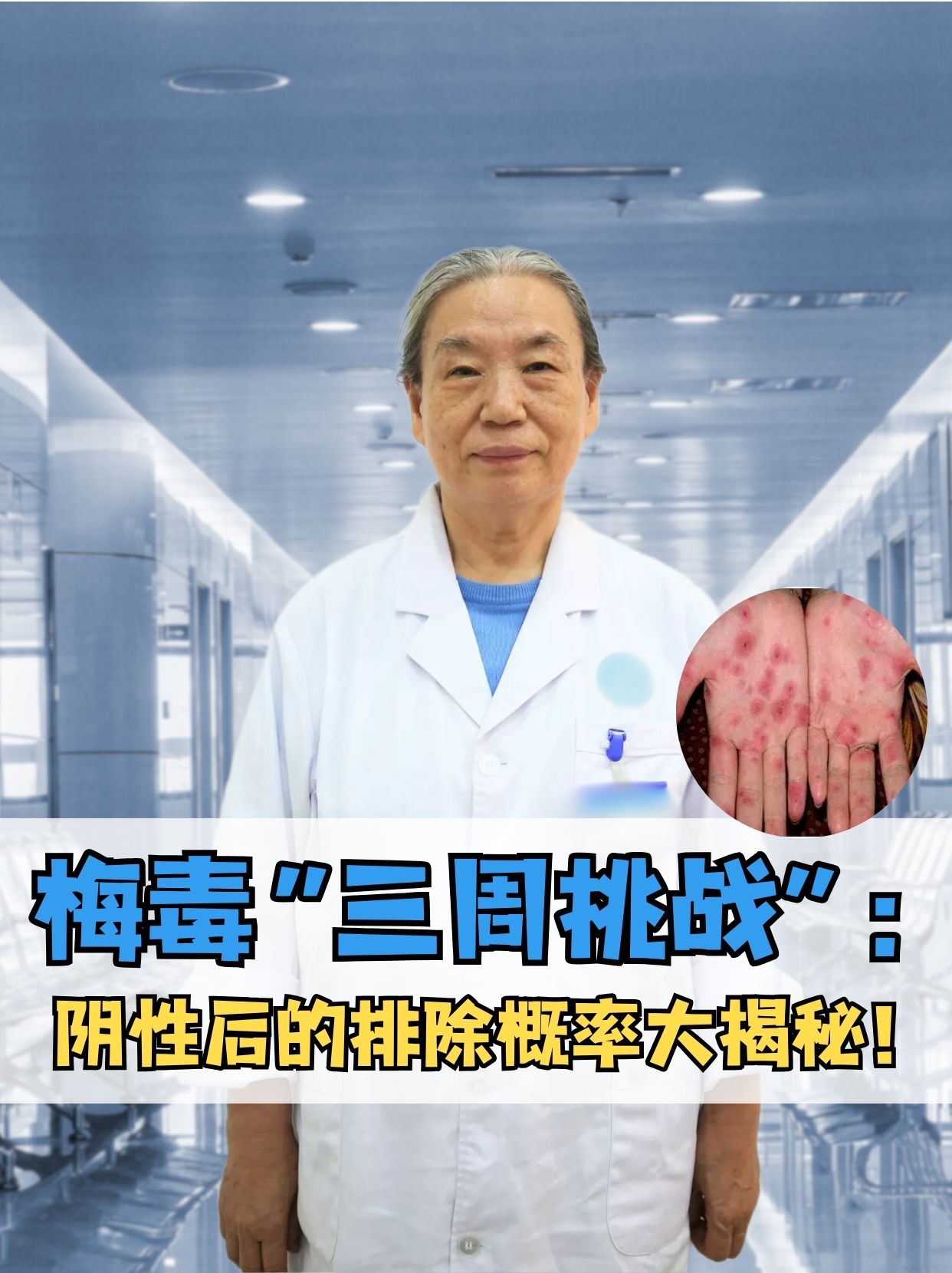 梅毒“三周挑战”：阴性后的排除概率大揭秘！