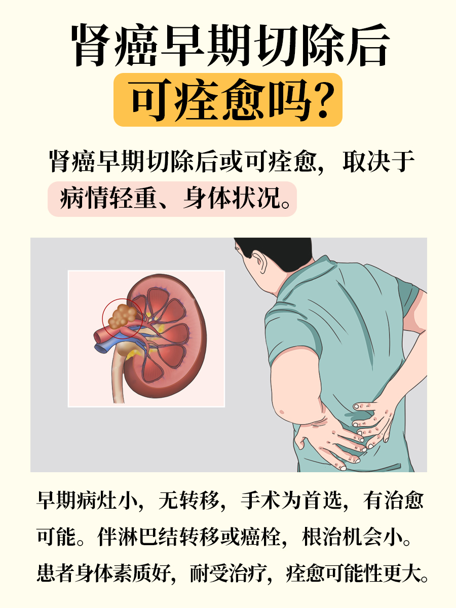 医生解答：肾癌早期切除后可痊愈吗？