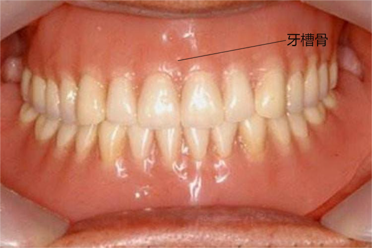 牙槽骨位置图 牙槽骨位置图