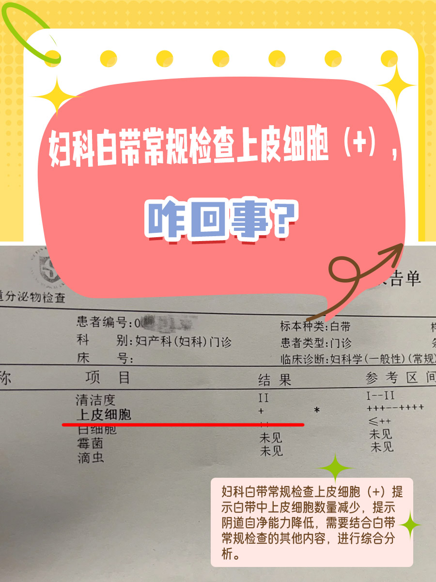 妇科白带常规检查上皮细胞（+），咋回事？