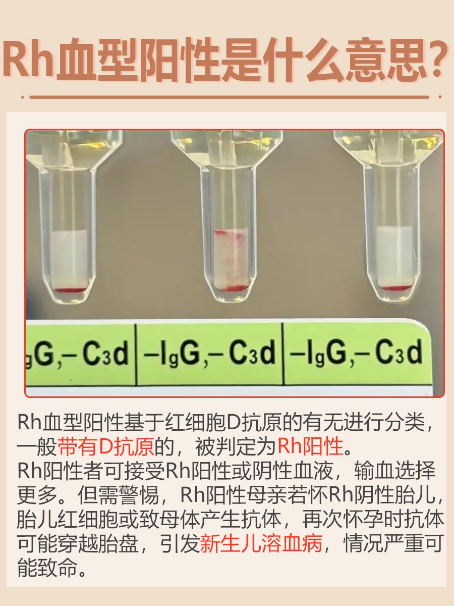 Rh血型阳性解读：你不可不知的血型常识