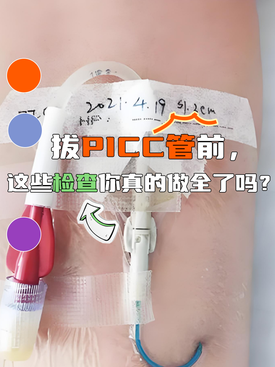 拔PICC管前，这些检查你真的做全了吗？