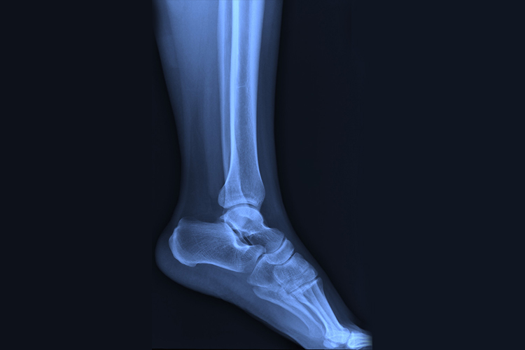 脚位置图 脚位置图