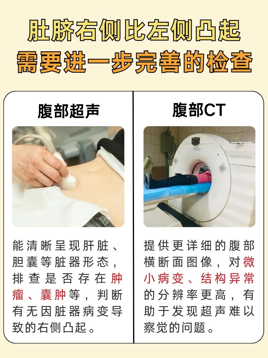 别错过！肚脐右侧比左侧凸咋回事？快瞧瞧