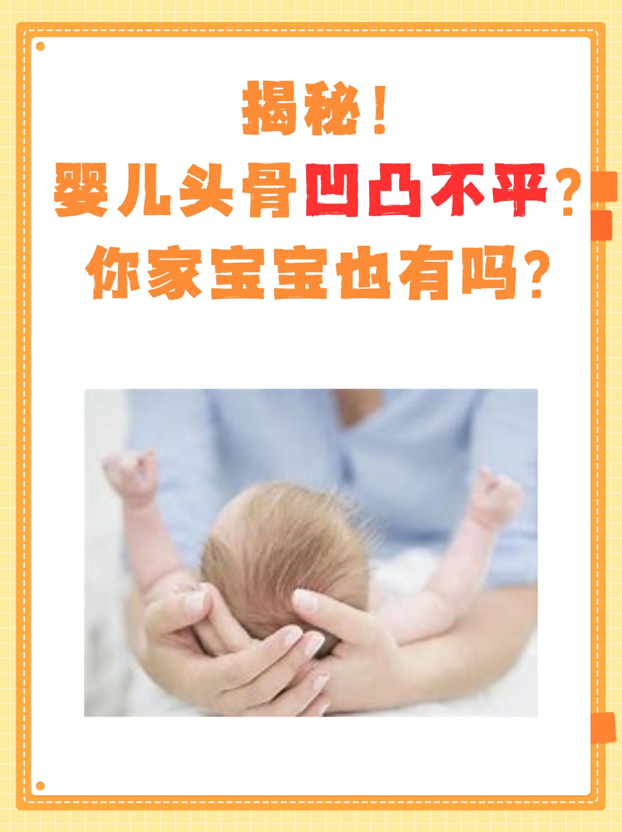 揭秘婴儿头骨凹凸不平之谜，你家宝宝也有吗？