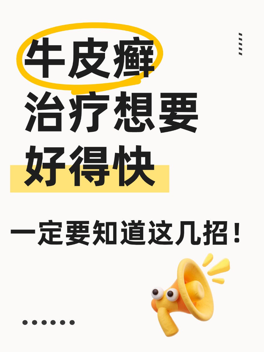 牛皮癣治疗好得快的方法，照着做少走弯路！