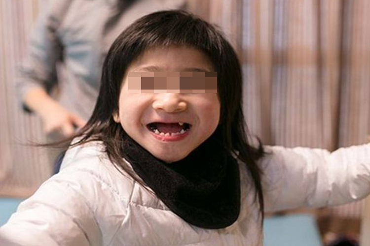 天使综合征快乐表情图