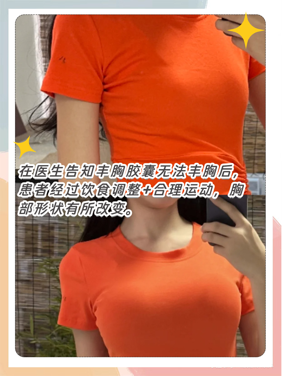丰胸胶囊作用大起底，它真的能丰胸吗？
