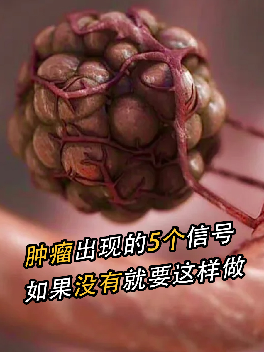 警惕！出现这几个信号，可能是肿瘤的征兆！