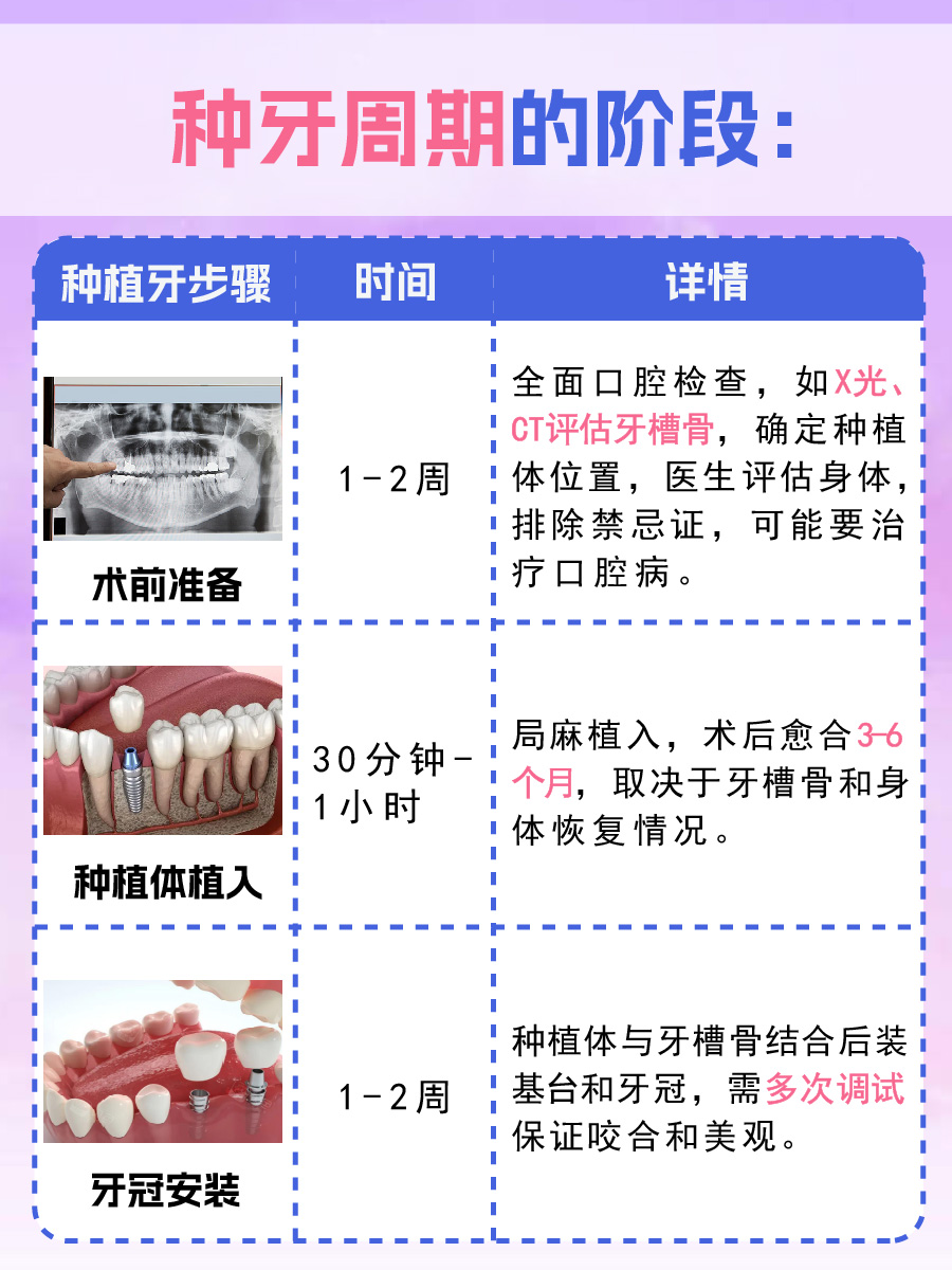 揭秘！种牙周期一般多长