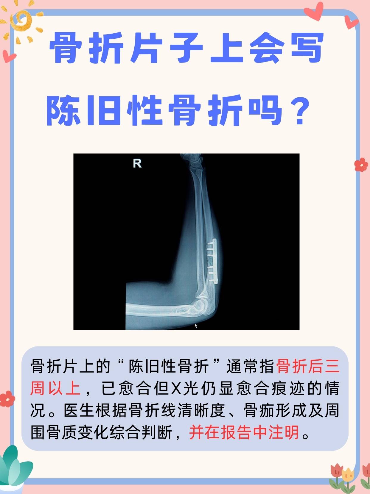 骨折片子上会写陈旧性骨折吗？揭秘