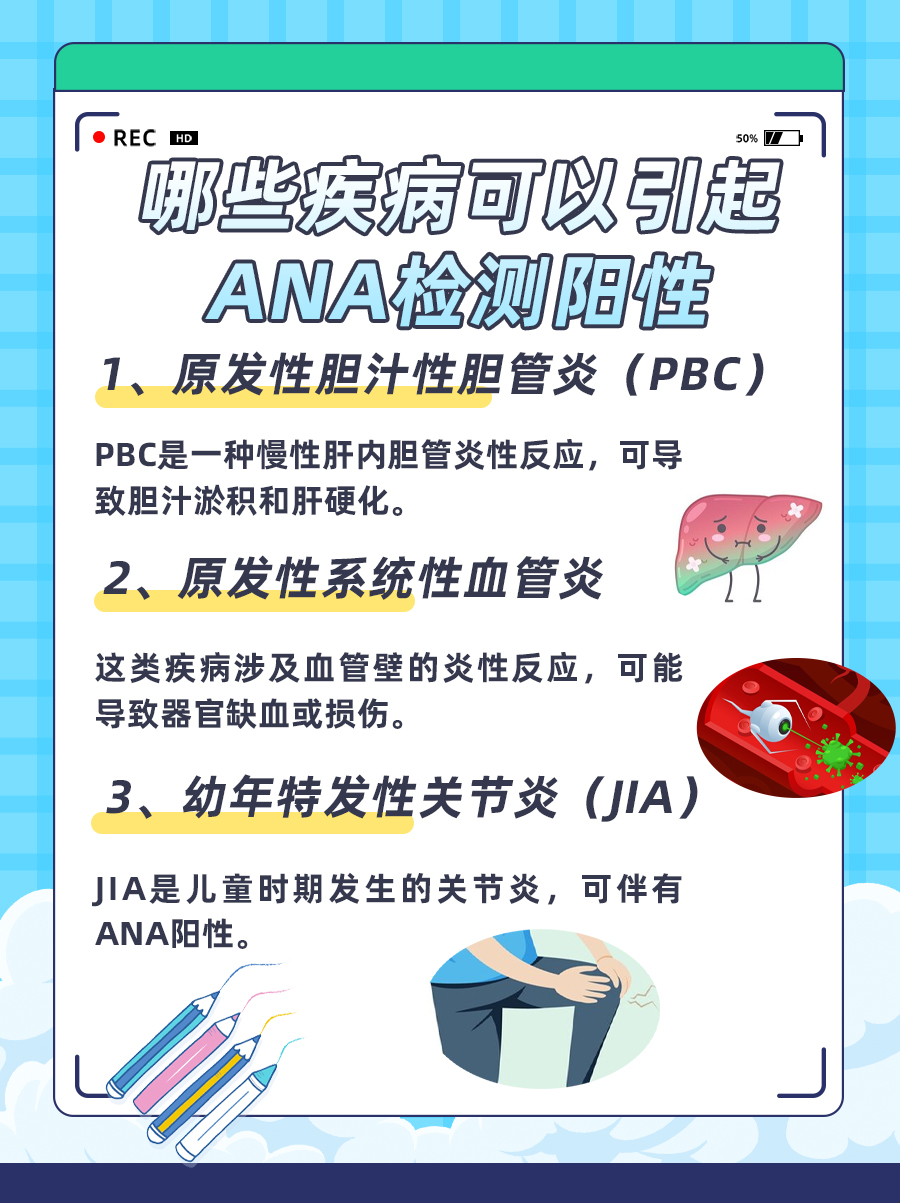 ANA检测阳性？可能是这些疾病的征兆！