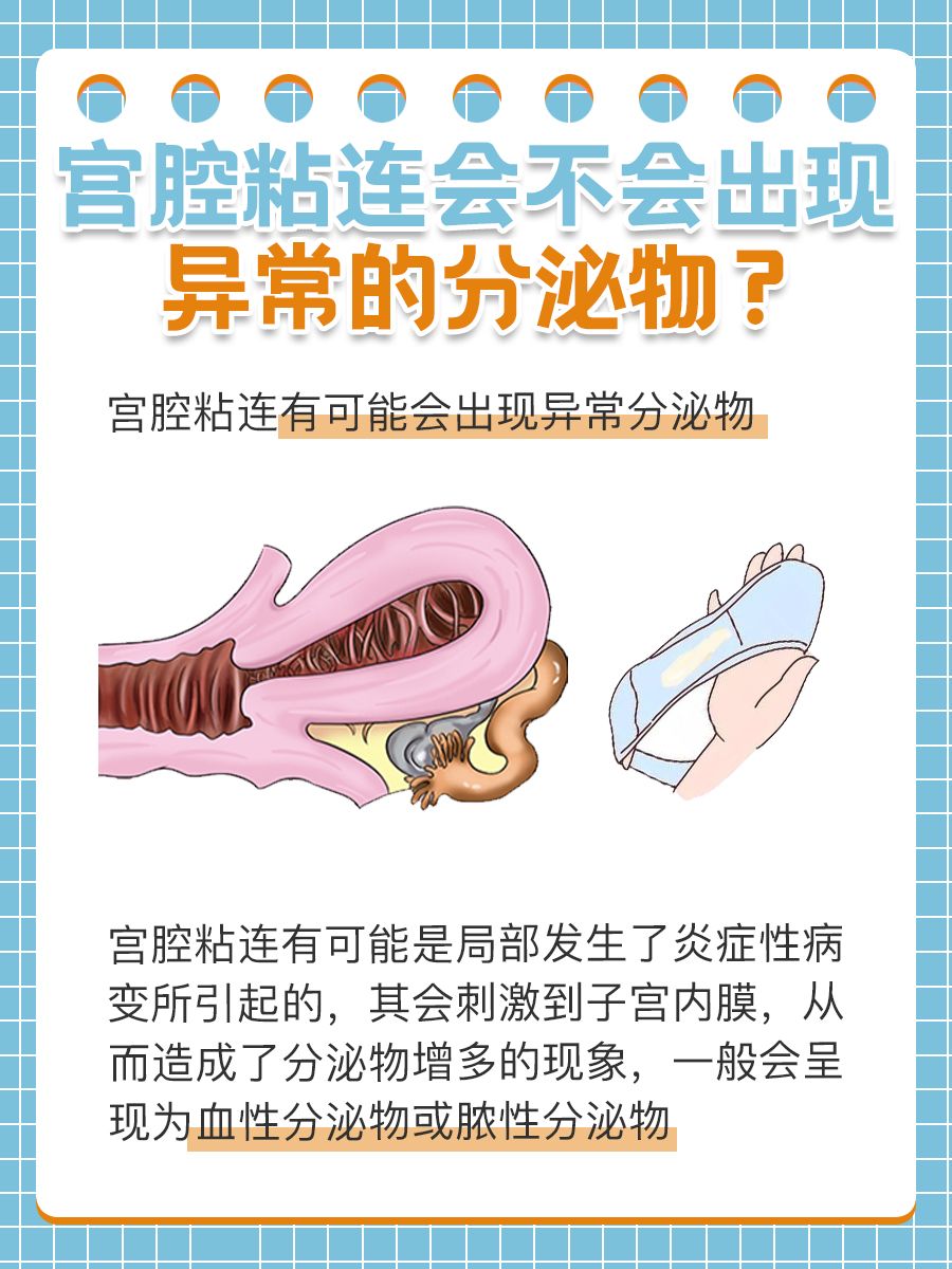 医生视角：宫腔粘连是否会有异常分泌物？