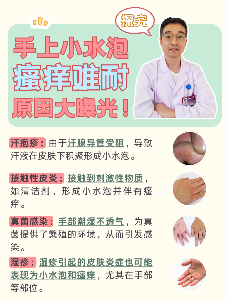 探究：手上小水泡瘙痒难耐，原因大曝光！