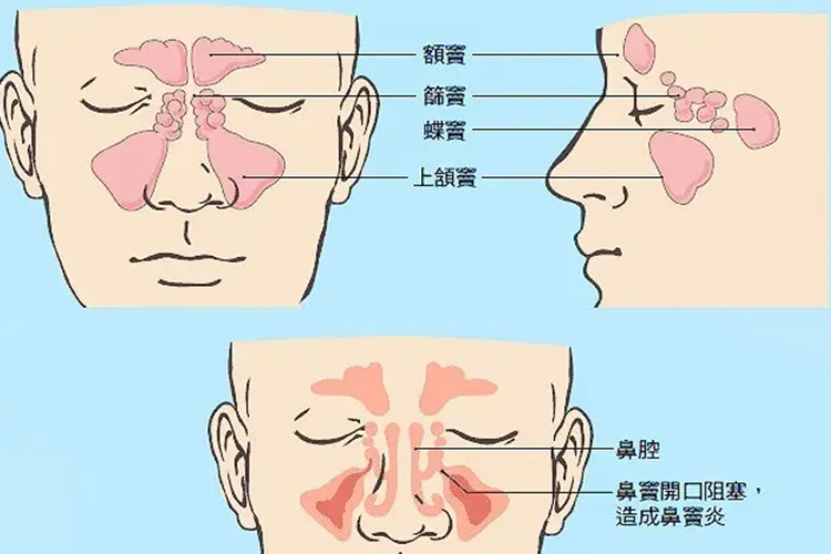 鼻窦位置图