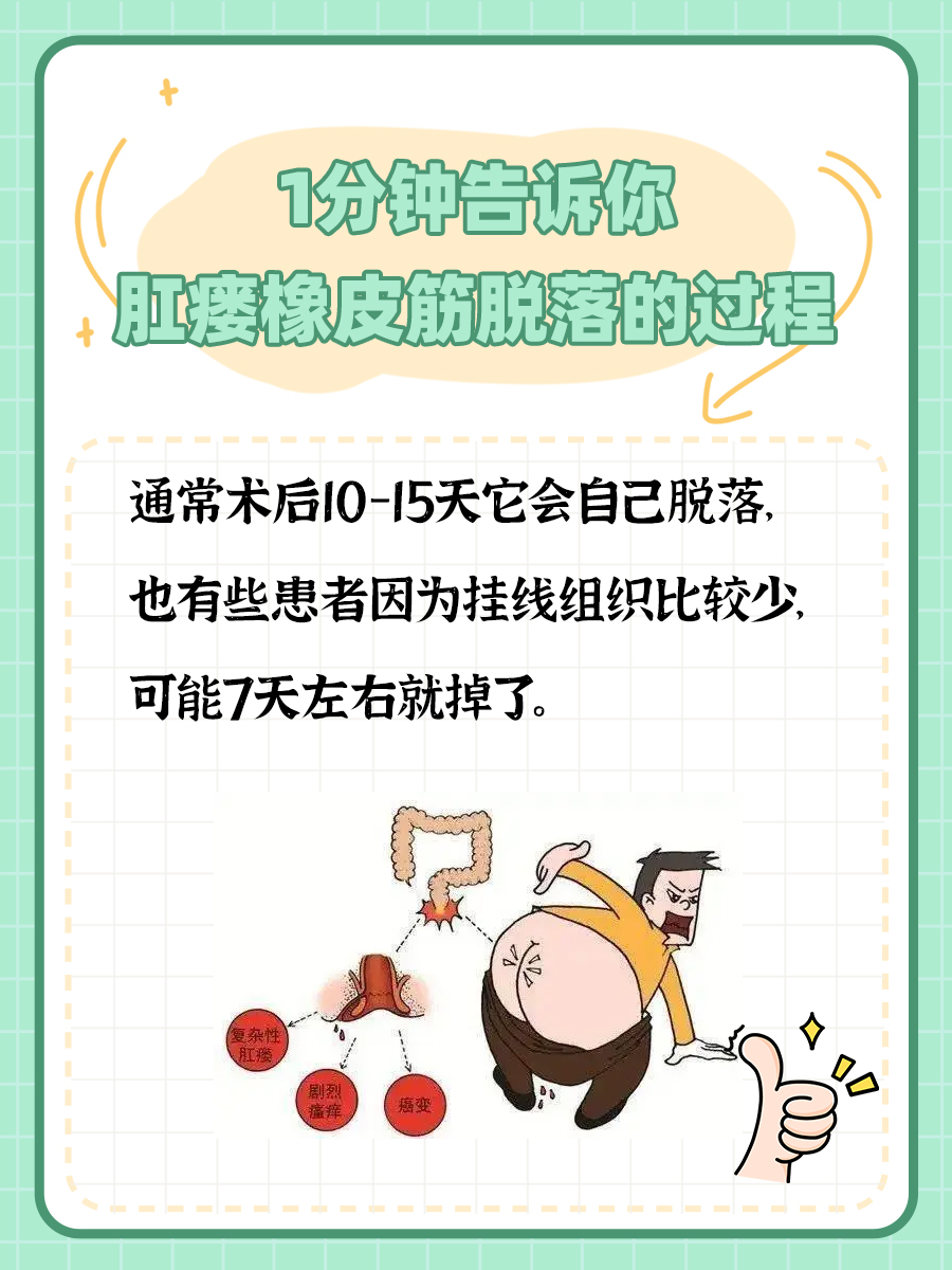 1分钟告诉你肛瘘橡皮筋脱落的全过程