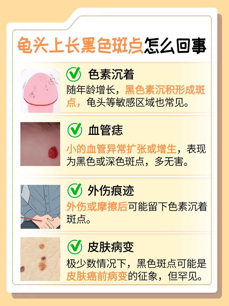 龟头上长黑色斑点怎么回事？一文解析