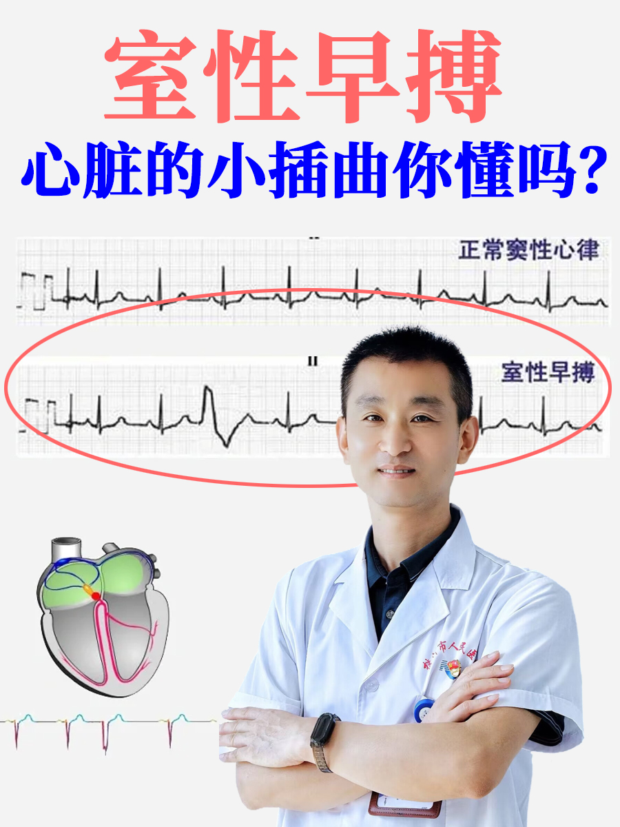 室性早搏，心脏的小插曲你懂吗？