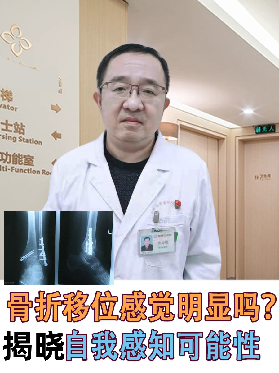 骨折移位感觉明显吗?揭晓自我感知可能性