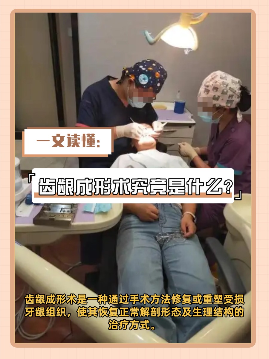 一文读懂：齿龈成形术究竟是什么？