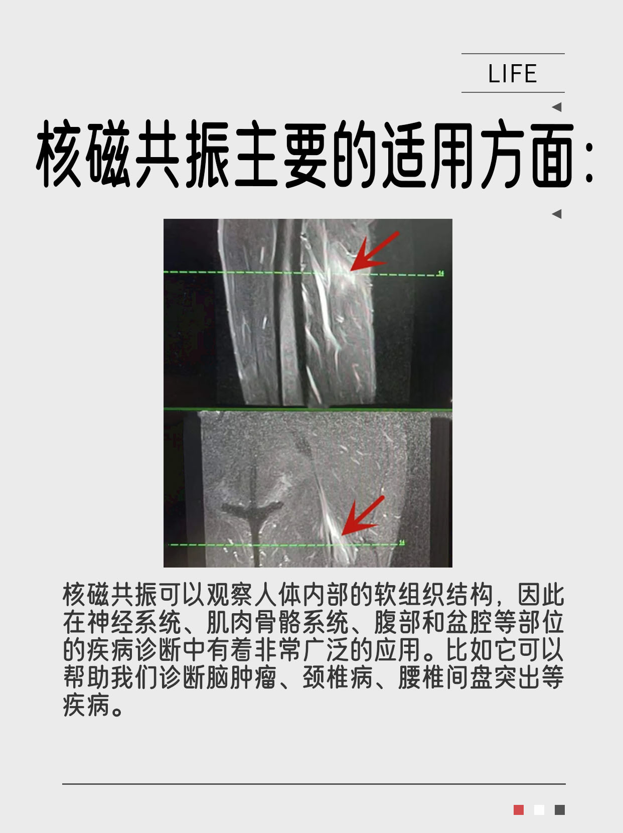 核磁共振室里的“神秘力量”：辐射？不存在的！