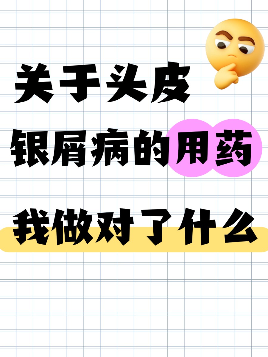 头皮银屑病用药怎么选？医生整理避坑指南