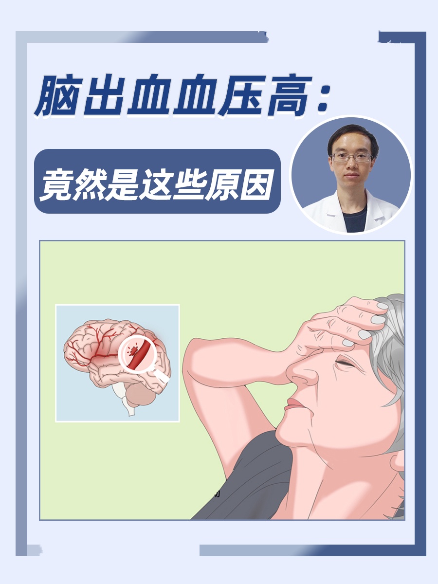 脑出血血压高:竟然是这些原因