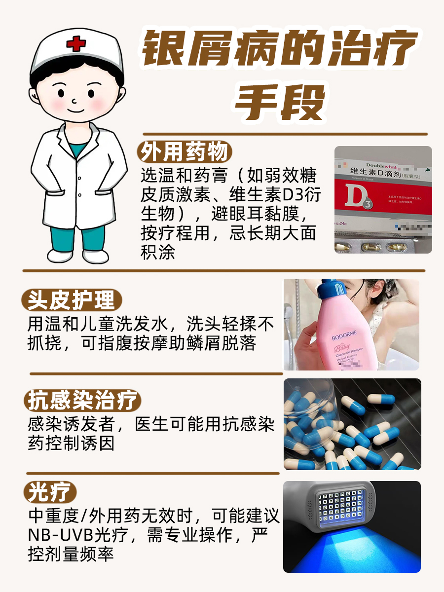小孩头上银屑病能治好吗?家长别慌!