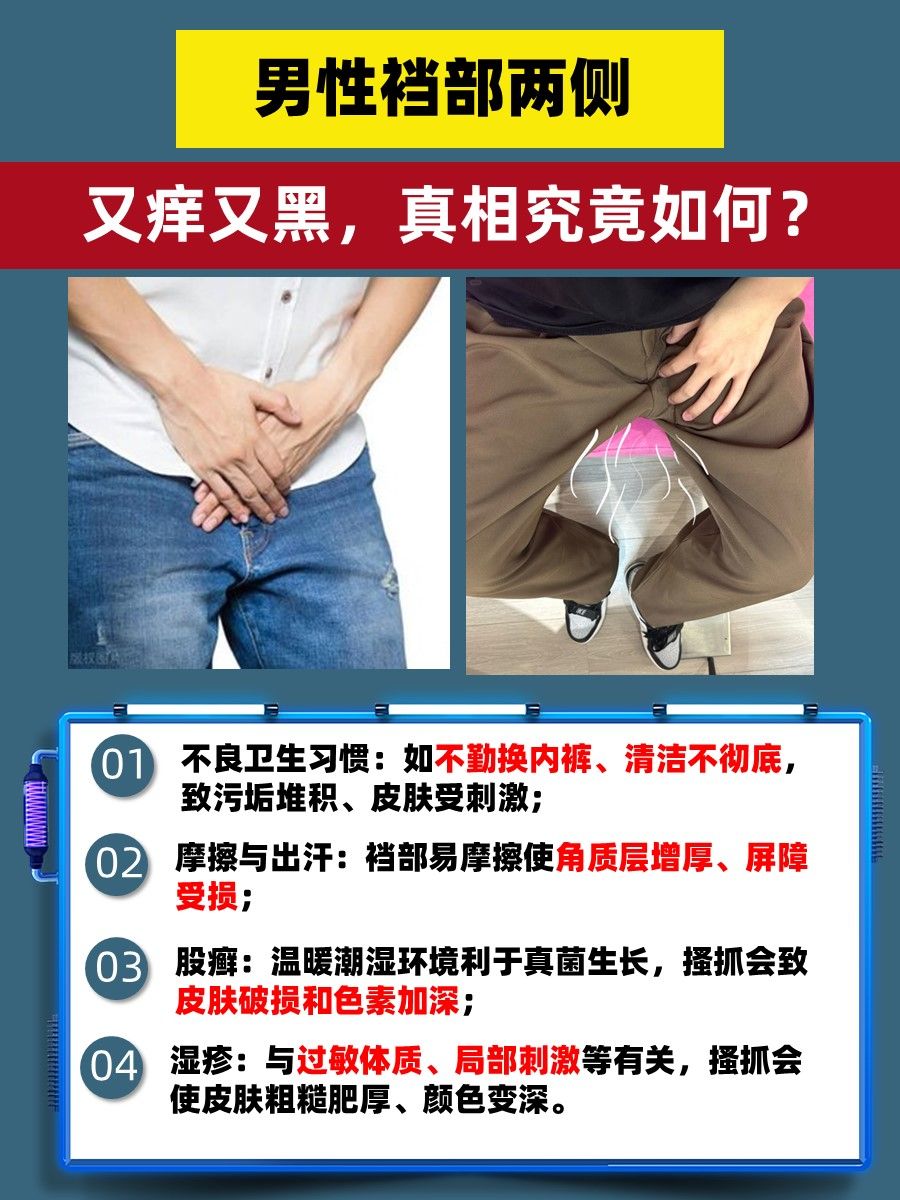 男性裆部两侧又痒又黑，真相究竟如何？