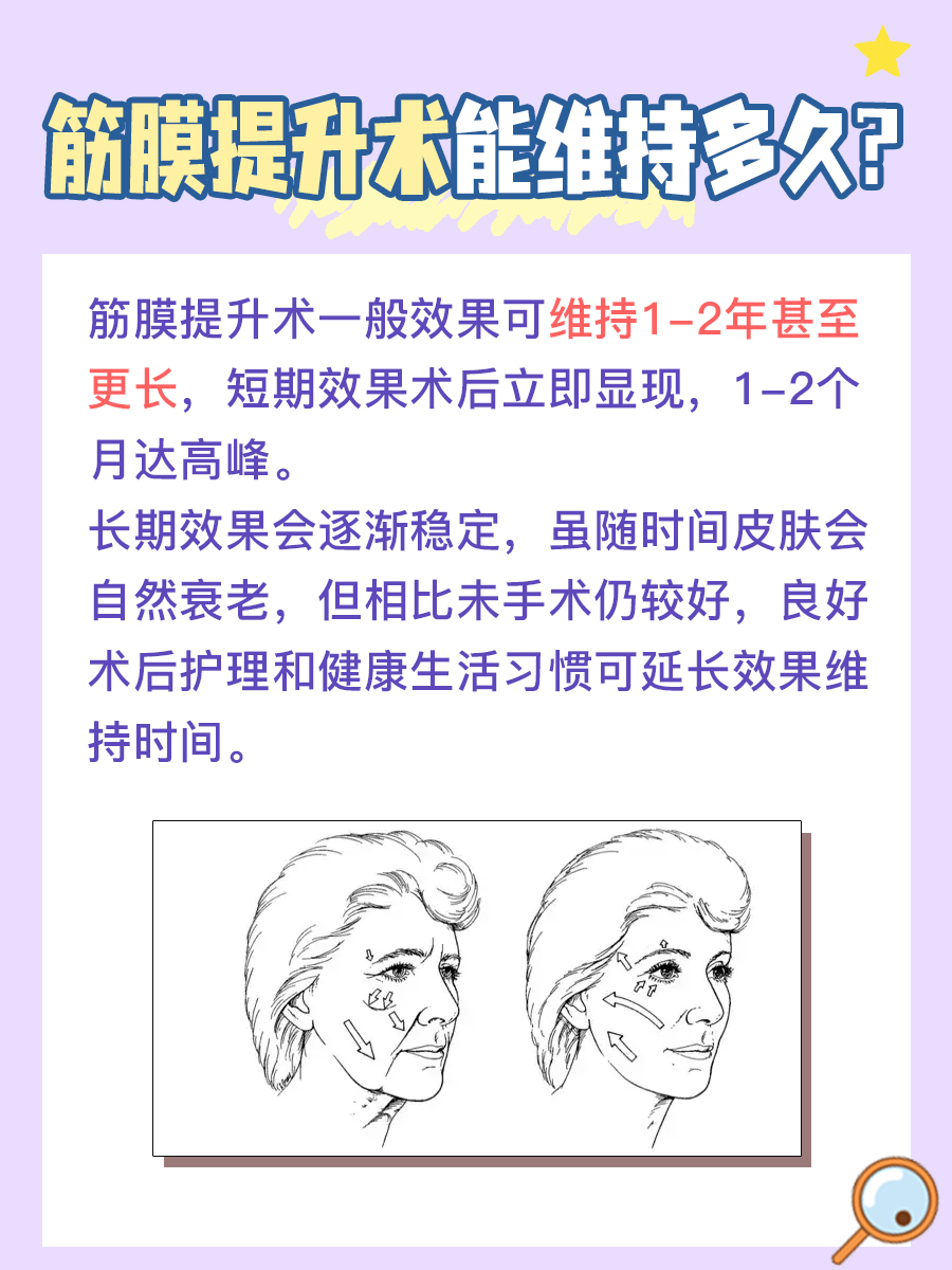 筋膜提升术能维持多久？一文了解