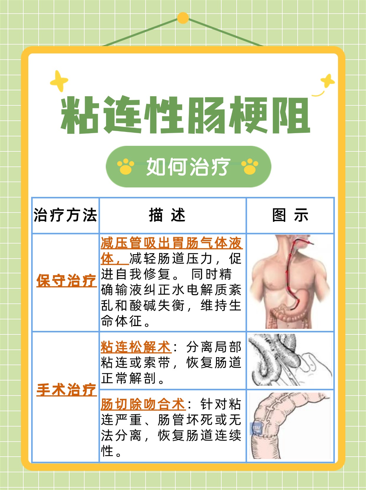 辟谣！没有粘连性肠梗阻最佳治疗方法一说~