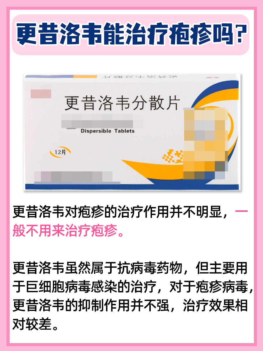 疱疹治疗解析，更昔洛韦是否有效？