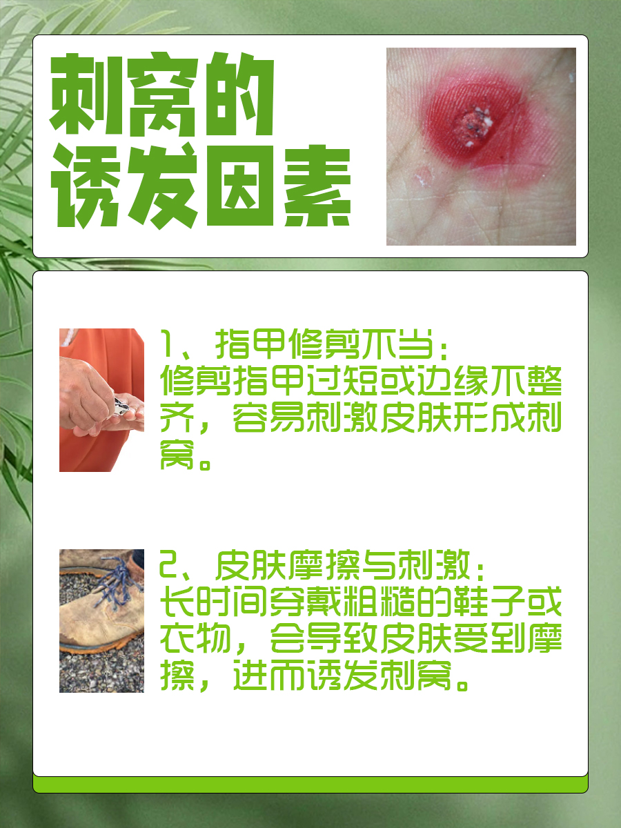 刺窝不再难缠，专业去除技巧大公开