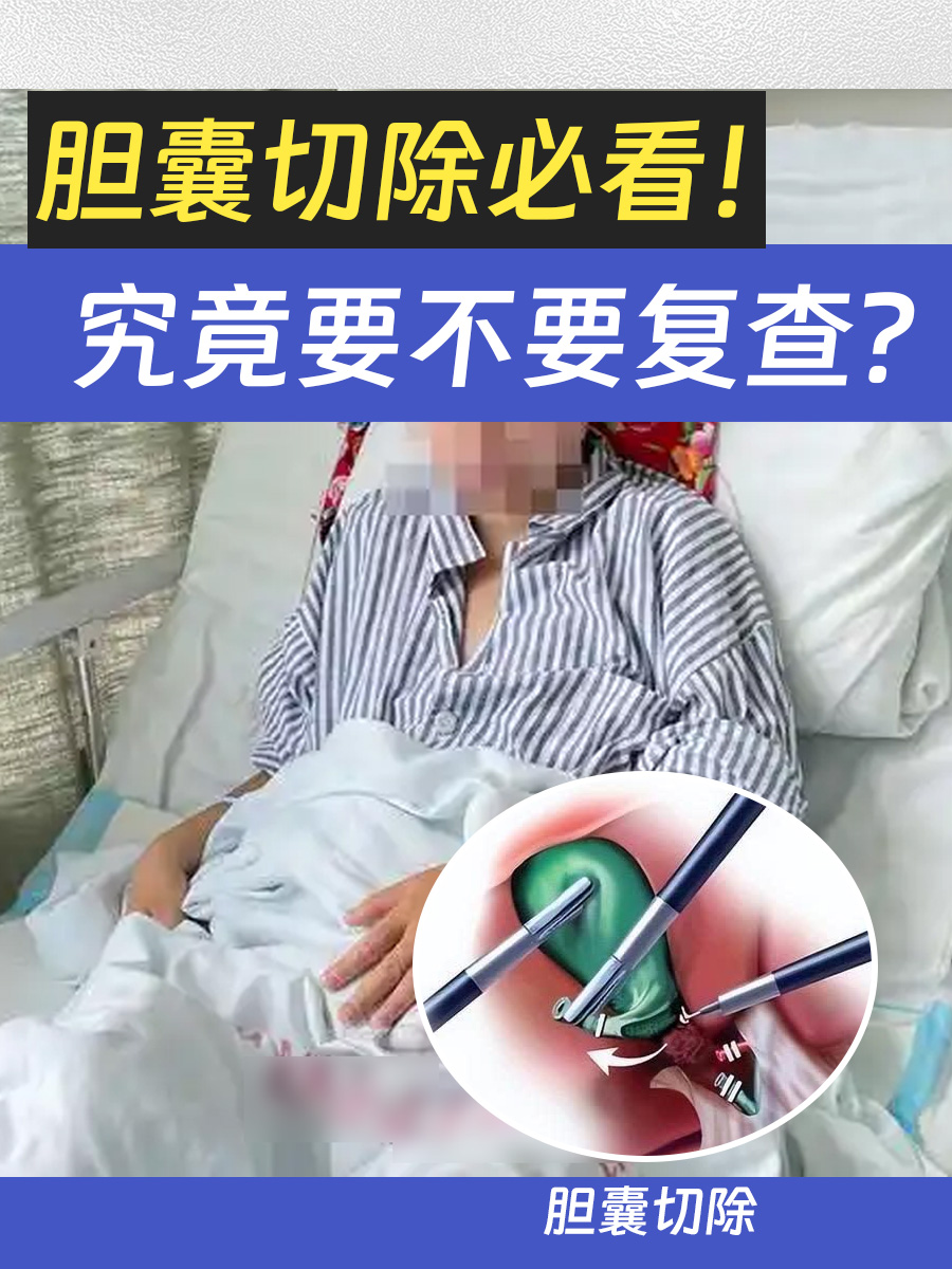 胆囊切除必看！究竟要不要复查？