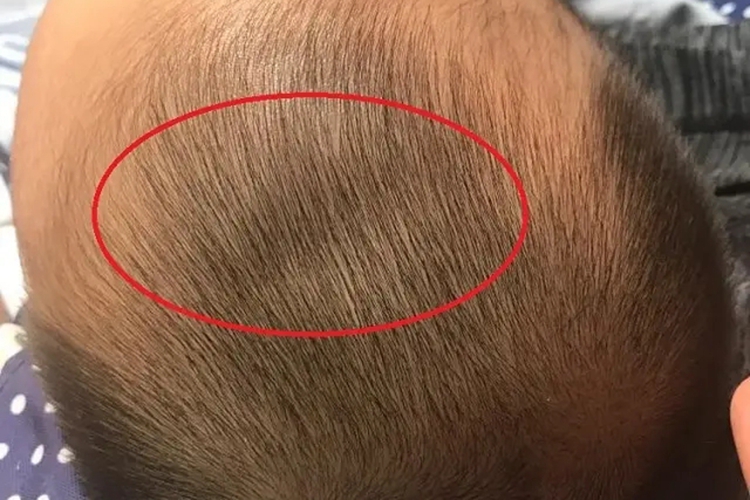 宝宝头颅有明显骨缝图