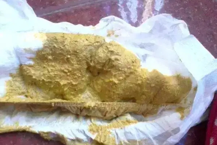 人工喂养新生儿粪便图