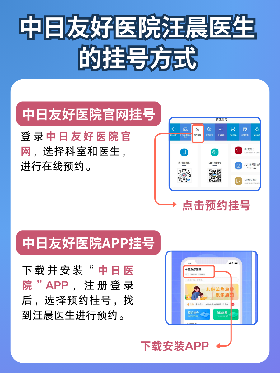 中日友好医院汪晨医生怎么样?怎么挂号?