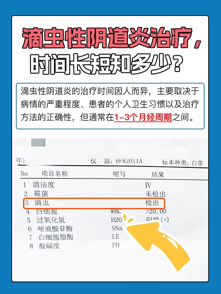 滴虫性阴道炎治疗，时间长短知多少？