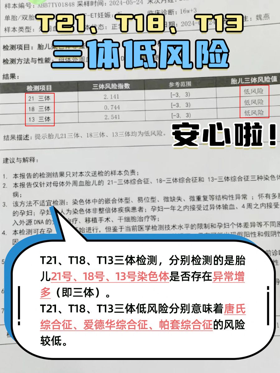 T21、T18、T13三体低风险,安心啦!